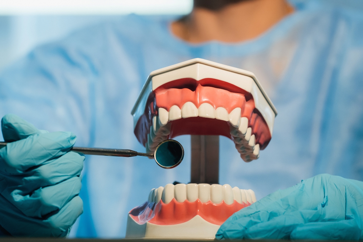All-on-4-dental-implants